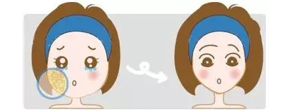 想要瘦脸?溶脂针跟瘦脸针要选哪个?